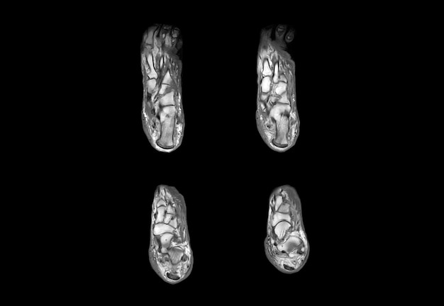 Ressonância magnética do pé e imagem de raio-x de tomografia computadorizada
