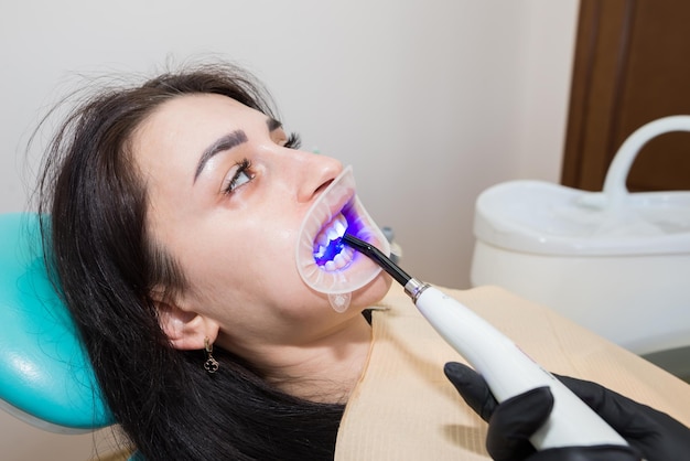 Foto restauração de dentes com lâmpada de polimerização de enchimento