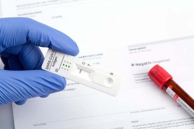 Foto resultado de teste negativo usando dispositivo de teste rápido para covid19