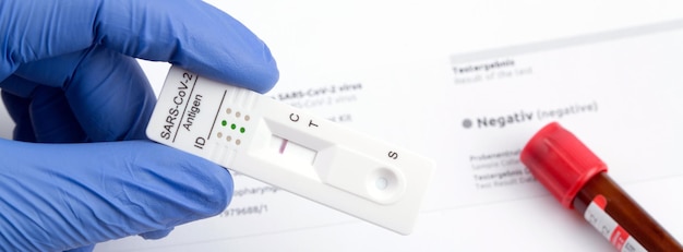 Resultado de teste negativo usando dispositivo de teste rápido para COVID19