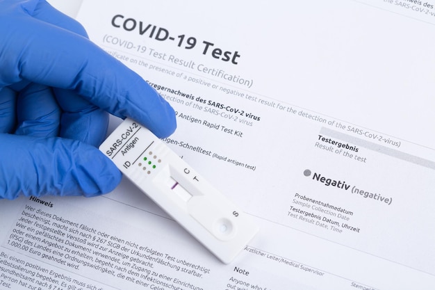 Resultado de teste negativo usando dispositivo de teste rápido para COVID19