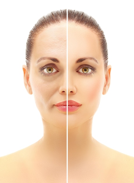 Resultados de la cirugía plástica Pliegues nasolabiales Bajo los ojos círculos líneas del cuello