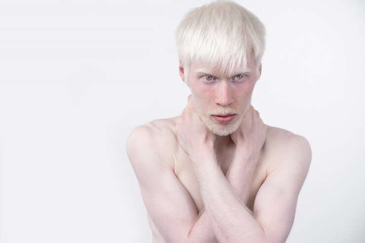 Foto retrato de um homem albino em um estúdio