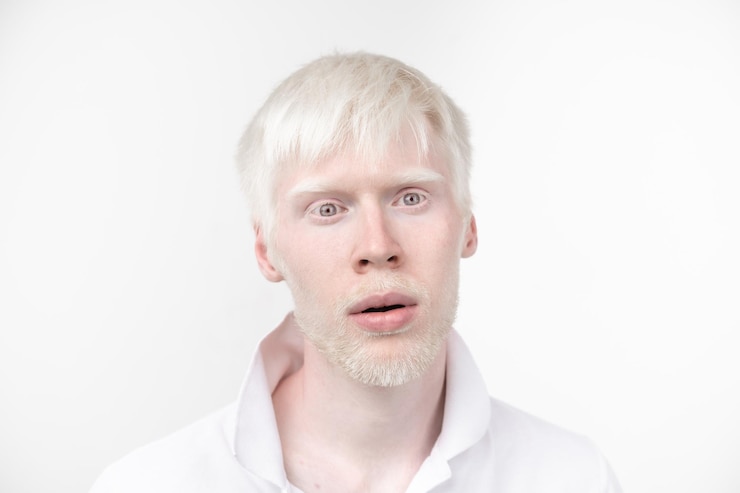 Foto retrato de um jovem com albino contra fundo branco