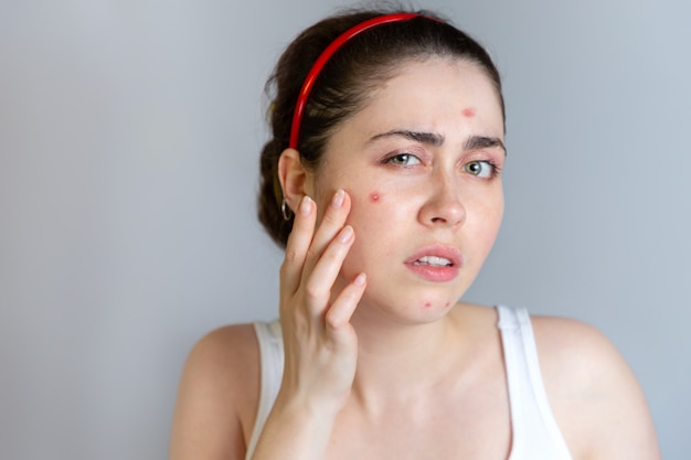 Retrato de uma jovem mulher examinando seu rosto com espinhas
