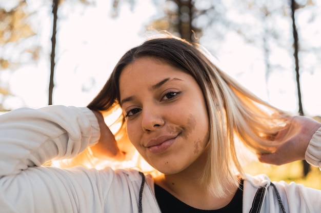 Retrato de uma menina bonita com uma marca de nascença no rosto ao ar livre.