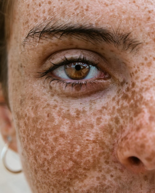 Foto retrato em close-up de mulher com sardas