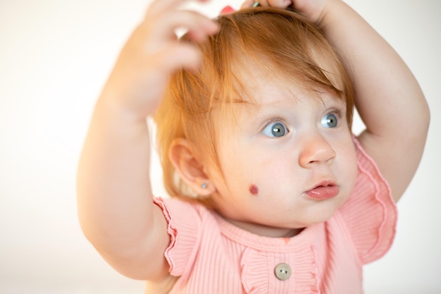 Retrato de una encantadora y graciosa niña pelirroja con ojos azules y una marca de nacimiento en la mejilla Hemangioma Fondo claro Estilo de vida