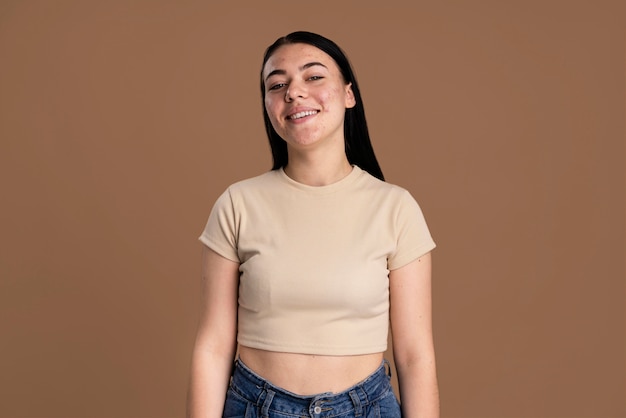 Retrato frontal de uma jovem com acne