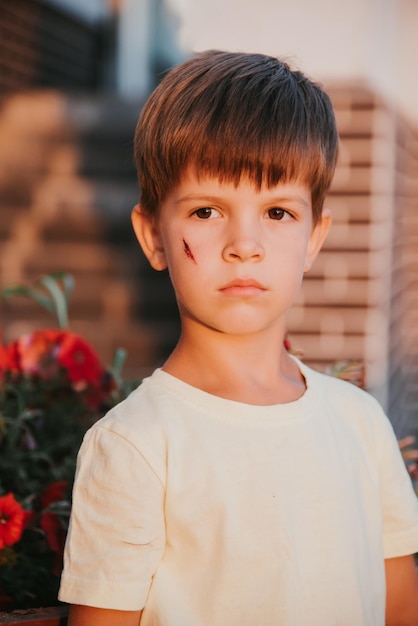 Retrato de un hermoso niño con una cicatriz en la cara