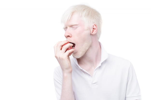 Retrato de un hombre albino comiendo una manzana