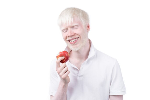 Retrato de un hombre albino en estudio vestido camiseta aislado sobre fondo blanco. desviaciones anormales. apariencia inusual