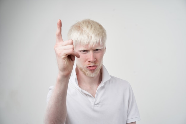 Retrato de un hombre albino en un estudio.