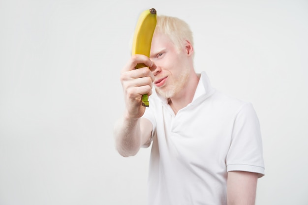 Retrato de un hombre albino sosteniendo un plátano