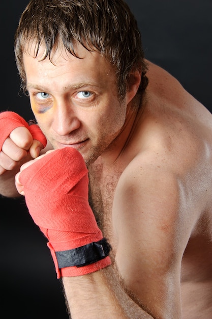 Retrato de un hombre con un hematoma en posición de batalla. Puños cerrados. Fondo oscuro.