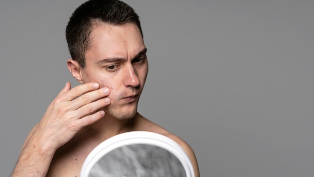 Foto retrato de hombre joven con acné y espacio de copia