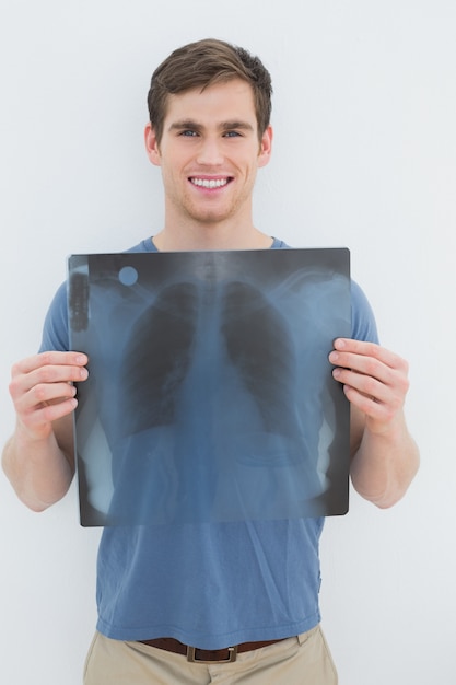 Retrato de un hombre joven sonriente con radiografía de pulmón