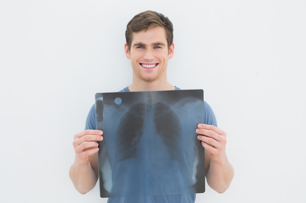 Retrato de un hombre joven sonriente con radiografía de pulmón