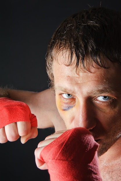 Retrato de un hombre con un ojo morado en una posición de batalla. Puños cerrados. Fondo oscuro.