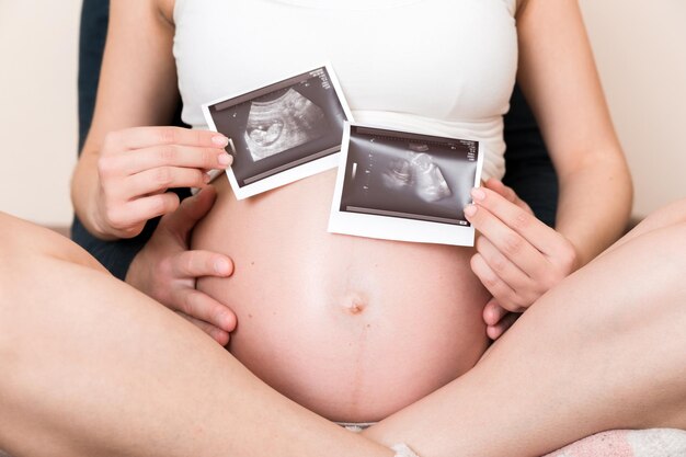 Foto retrato de una joven pareja casada feliz con una imagen de ultrasonido un hombre y una mujer embarazadas muestran una imagen de sonograma en el niño. el niño está emocionado por la paternidad.