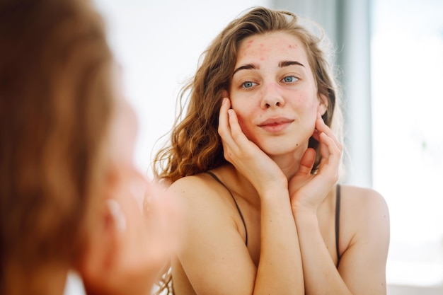 Foto retrato de una mujer joven tocando una espinilla en la cara mientras se mira en el espejo problemas de la piel facial