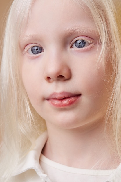 Retrato de niña albina con piel blanca y cabello blanco