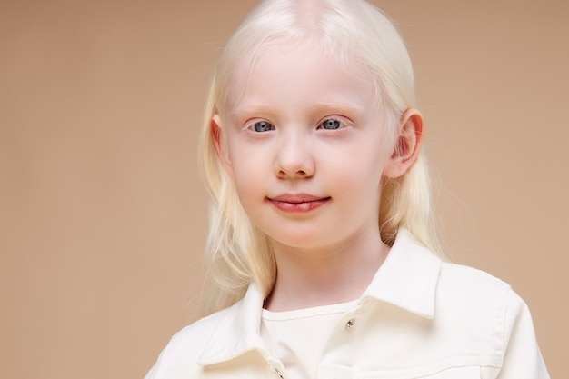 Retrato de niña sonriente niño albino aislado