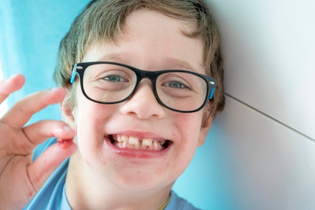 Retrato de un niño con gafas que muestra un hueso de una cereza que comió Un niño alegre en casa entre la familia Una infancia feliz y despreocupada