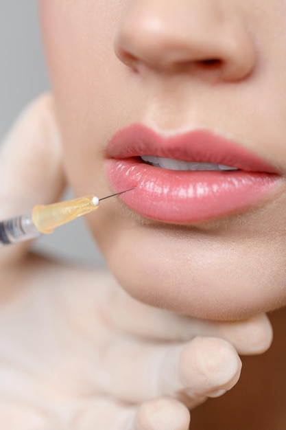 Retrato de primer plano de mujer recibiendo inyección de elevación cosmética en los labios. Operacion plastica. Tratamiento cosmético