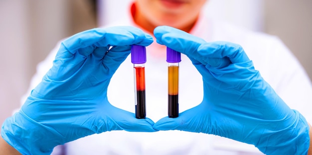 Retrato de un trabajador médico encantador que sostiene dos tubos de ensayo con sangre en el laboratorio Enfermera educada en uniforme médico y guantes estériles azules muestra viales de líquido