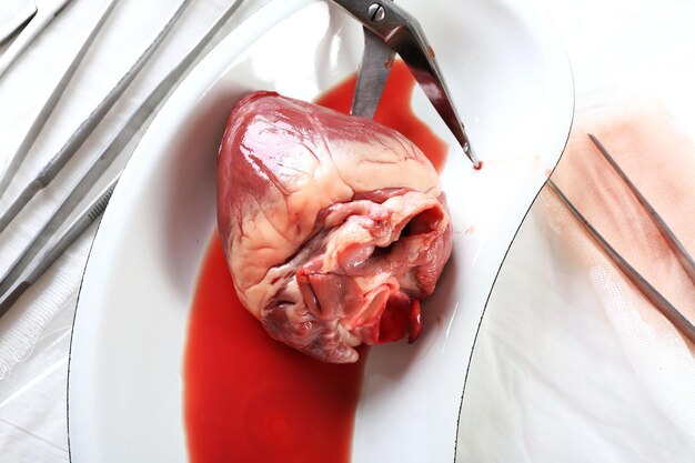 Órgano del corazón en bandeja médica de metal con herramientas en la mesa de cerca