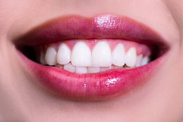 Riendo la boca de la mujer con grandes dientes. Sonrisa perfecta después de la decoloración. Cuidado dental y blanqueamiento de dientes. Sonrisa sana, pequeña.