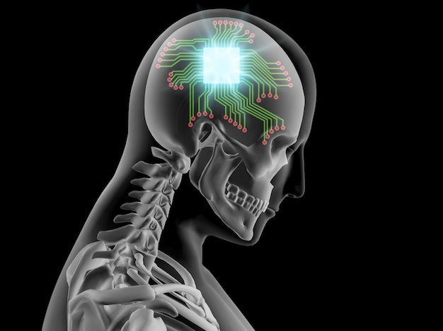 Röntgenstrahl 3D des menschlichen Gehirns mit Computerchip und Stromkreis