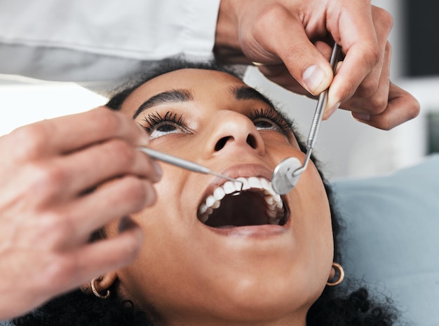 Foto rosto bucal de mulher e dentista com ferramentas para avaliação e teste de saúde bucal na clínica ortodontia de bem-estar oral e paciente com espelho médico e escavadeira para limpeza de dentes