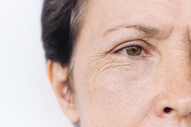 Foto rosto de mulher idosa com inchaço e rugas faciais sob os olhos alterações cutâneas relacionadas à idade