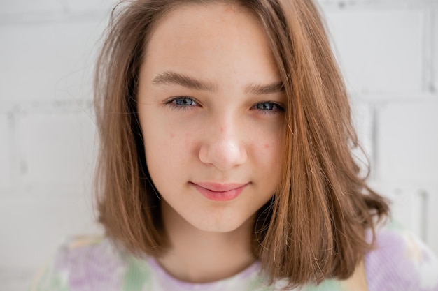 Rosto de uma adolescente em close-up. Adolescente com pele problemática. Garota com um penteado quadrado. Acne e cicatrizes. Retrato natural. Sem maquiagem e retoque. Foto de alta qualidade