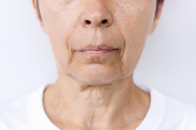 Rosto e pescoço de mulher caucasiana idosa com sinais de envelhecimento da pele Rugas faciais flácidas e flácidas
