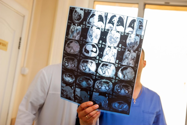 Ärztin mittleren Alters diskutiert mit ihrem älteren Schlaganfallpatienten ctscan-Bilder ihres Gehirns