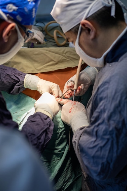 Foto samarkand, uzbequistão, 25 de fevereiro de 2024 cirurgião neurocirúrgico fazendo cirurgia teatro de operação hematoma subdural no cérebro múltiplo neurocirurgião cirurgia cerebral aberta1