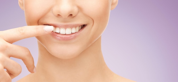 saúde dental, beleza, higiene e conceito de pessoas - close-up do rosto de mulher sorridente apontando para os dentes sobre fundo violeta
