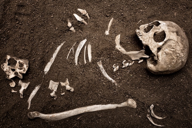 Schädel und Knochen