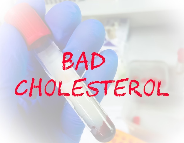 Schlechter Cholesterin-Begriff für medizinisches Konzeptbild.