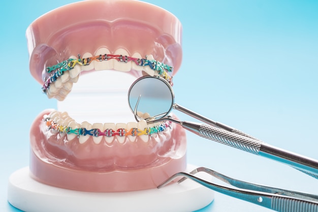 Schließen Sie herauf orthodontisches Modell und Zahnarztwerkzeug auf dem blauen Hintergrund