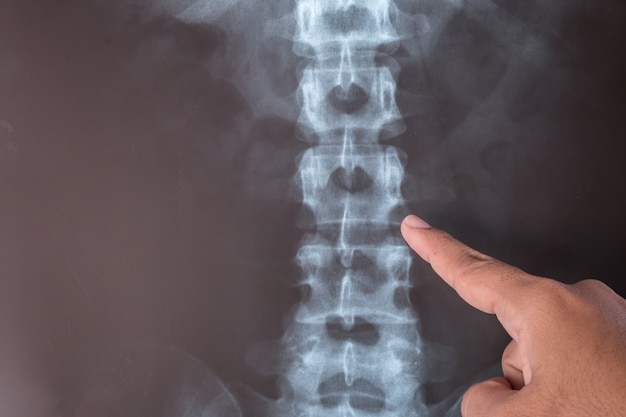 Schließen Sie herauf Röntgenstrahlbild des Menschen für eine medizinische Diagnose