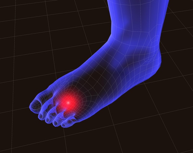 Schmerzender Fuß. 3D-Bild von Füßen und Schmerzen