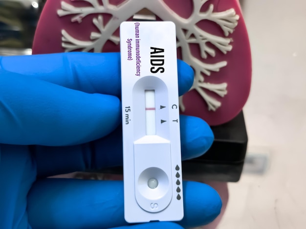 Schnelltestkassette für den AIDS-Test (erworbenes Immunschwächesyndrom) im medizinischen Labor