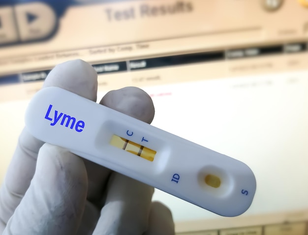 Schnelltestkassette zum Testen auf Borreliose.