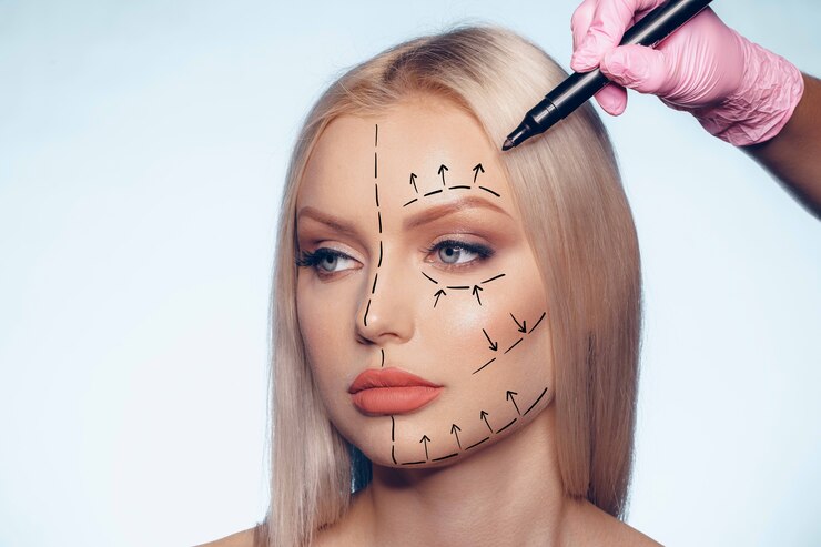 Schöne blonde Frau mit Markierungen für plastische Chirurgie im Gesicht