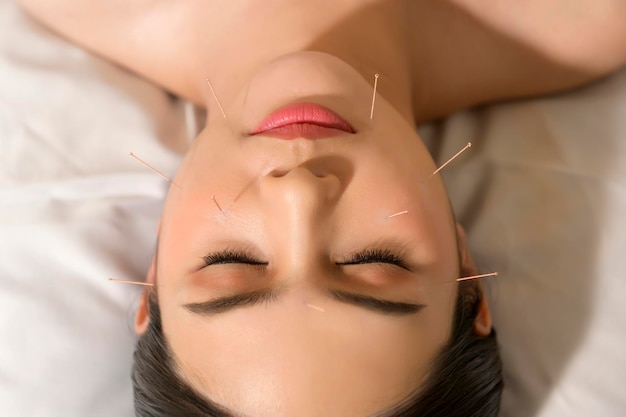 Schöne Frau erhielt eine Akupunkturbehandlung im Gesicht durch einen Therapeuten der chinesischen Medizin