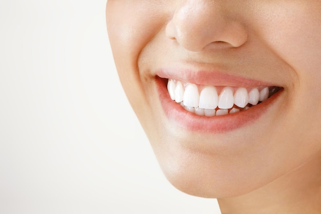 Schönes weibliches Lächeln nach dem Zahnaufhellungsverfahren Zahnpflege-Zahnheilkundekonzept